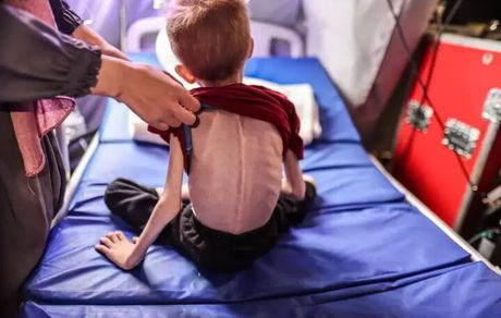 Gaza Health Ministry: 650,000 children on the verge of death